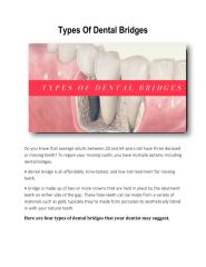 Types Of Dental Bridges.pdf